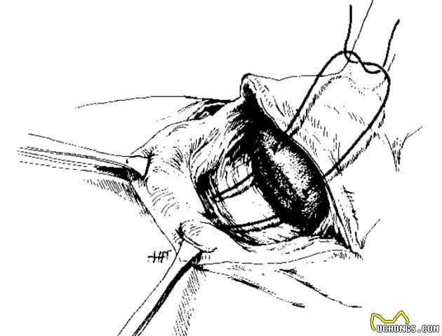 犬耳矫形术（Correctiveearsurgery）