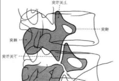 腰痛的原因竟然是身体里的小狗出了问题？