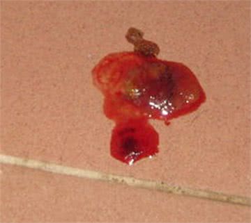 狗狗食物中毒以后会有什么症状,预防措施有哪些?