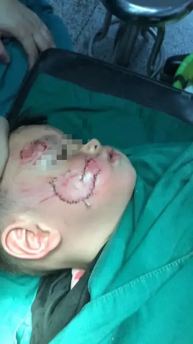 强烈建议立法:对宠物狗出门不拴绳的,依法捕杀,并对狗主人严惩